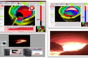 RAT_11